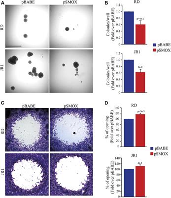 Spermine oxidase induces DNA damage and sensitizes fusion negative rhabdomyosarcoma cells to irradiation